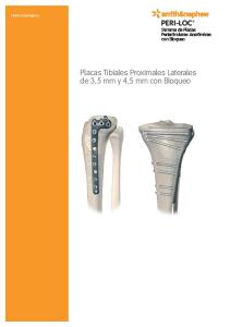 Placas Tibiales Proximales Laterales de 3,5 mm y 4,5 mm con Bloqueo